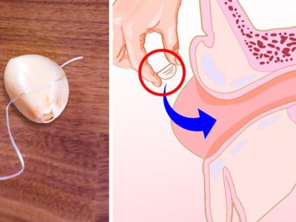 Kako s česnom zdraviti vnetja ušes?